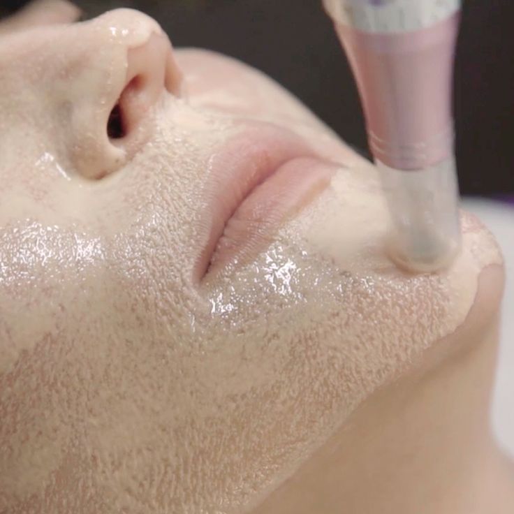 BB Glow Treatment in Hinjewadi
