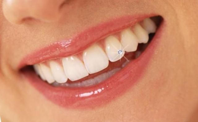 Find Best tooth jewellery in hinjewadi