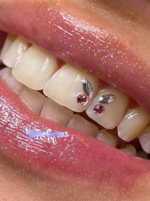 Tooth Jewellery in Hinjewadi