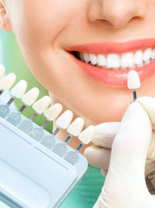 Teeth Cleaning Treatment in Hinjewadi
