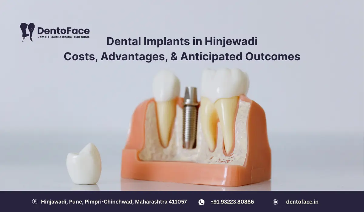 Dental Implants in Hinjewadi: Costs, Advantages, and Anticipated Outcomes