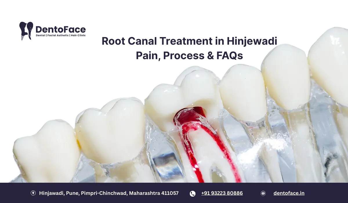 Root Canal Treatment in Hinjewadi: Pain, Process & FAQs