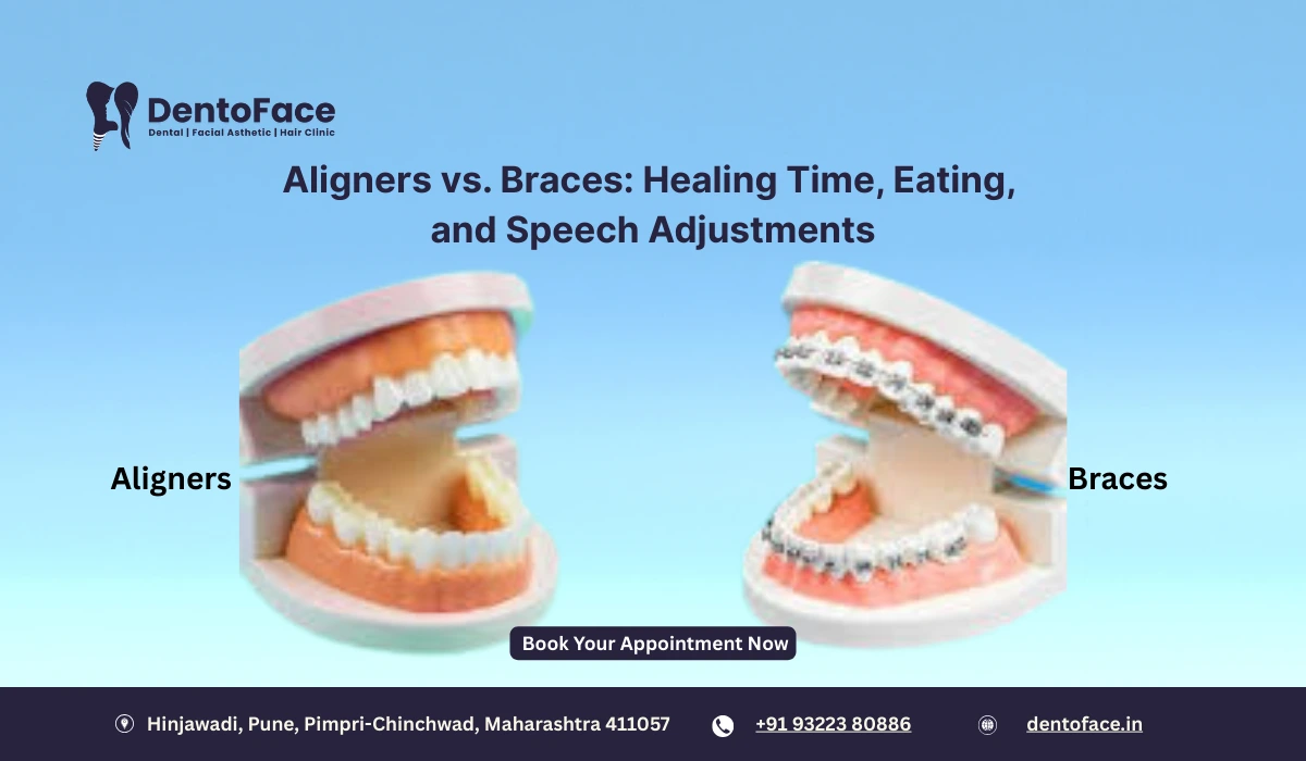 Aligners vs. Braces: Healing Time, Eating, and Speech Adjustments
