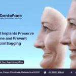 How Dental Implants Preserve Jawbone and Prevent Facial Sagging