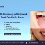 Teeth Cleaning in Hinjewadi – Best Dentist in Pune...