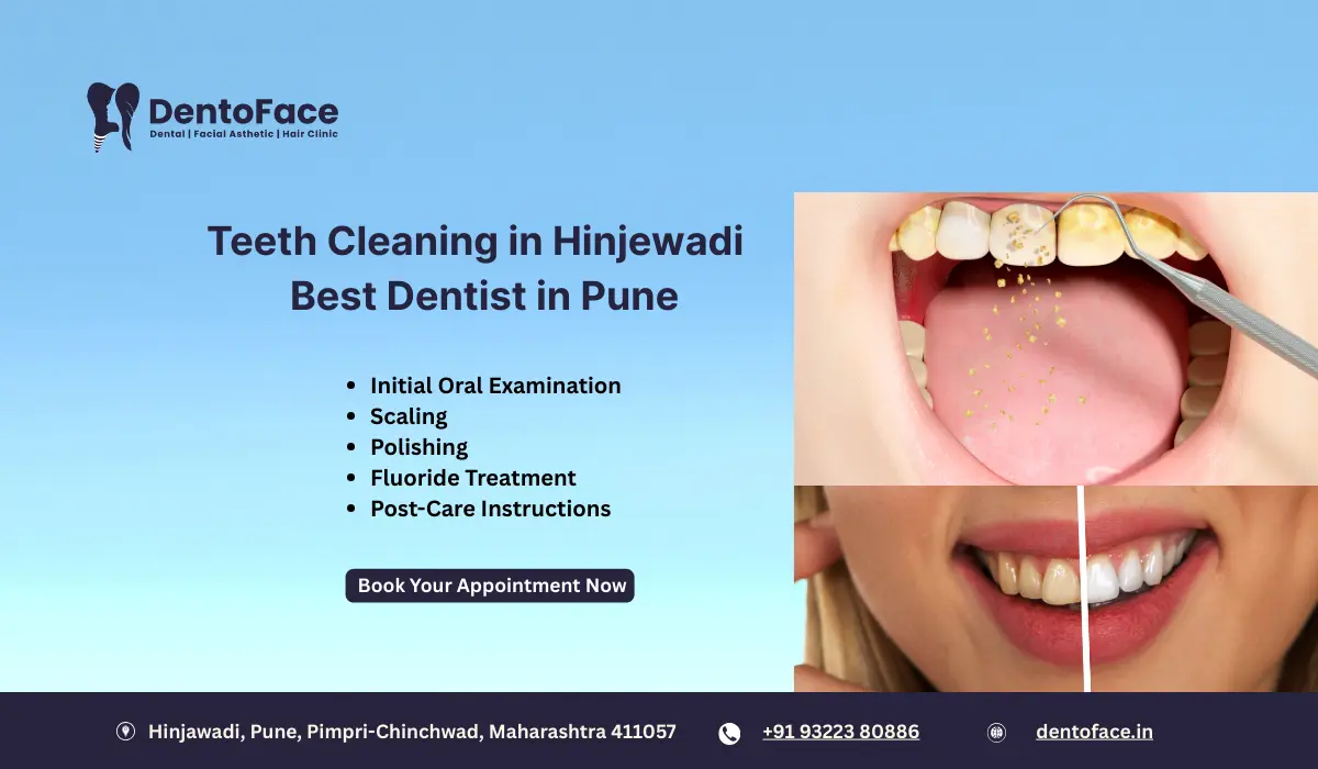 Teeth Cleaning in Hinjewadi – Best Dentist in Pune