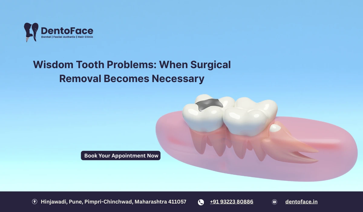 Wisdom Tooth Problems: When Surgical Removal Becomes Necessary