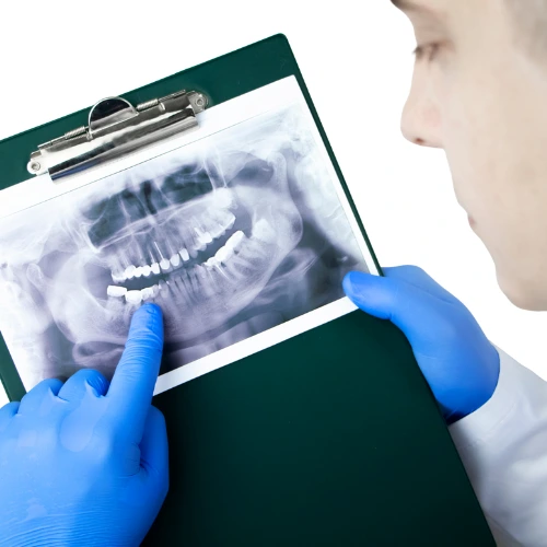 Digital X-Ray & 3D Scanning in Hinjewadi - Dentoface