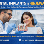 Dental implant consultation with dentist showing implant model to patient in dental clinic