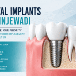 3D illustration of a dental implant replacing a missing tooth, showcasing a natural-looking and durable permanent tooth replacement solution in Hinjewadi.
