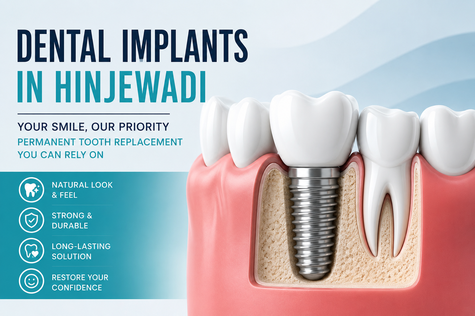 Dental Implants in Hinjewadi: A Long-Term Solution for Missing Teeth